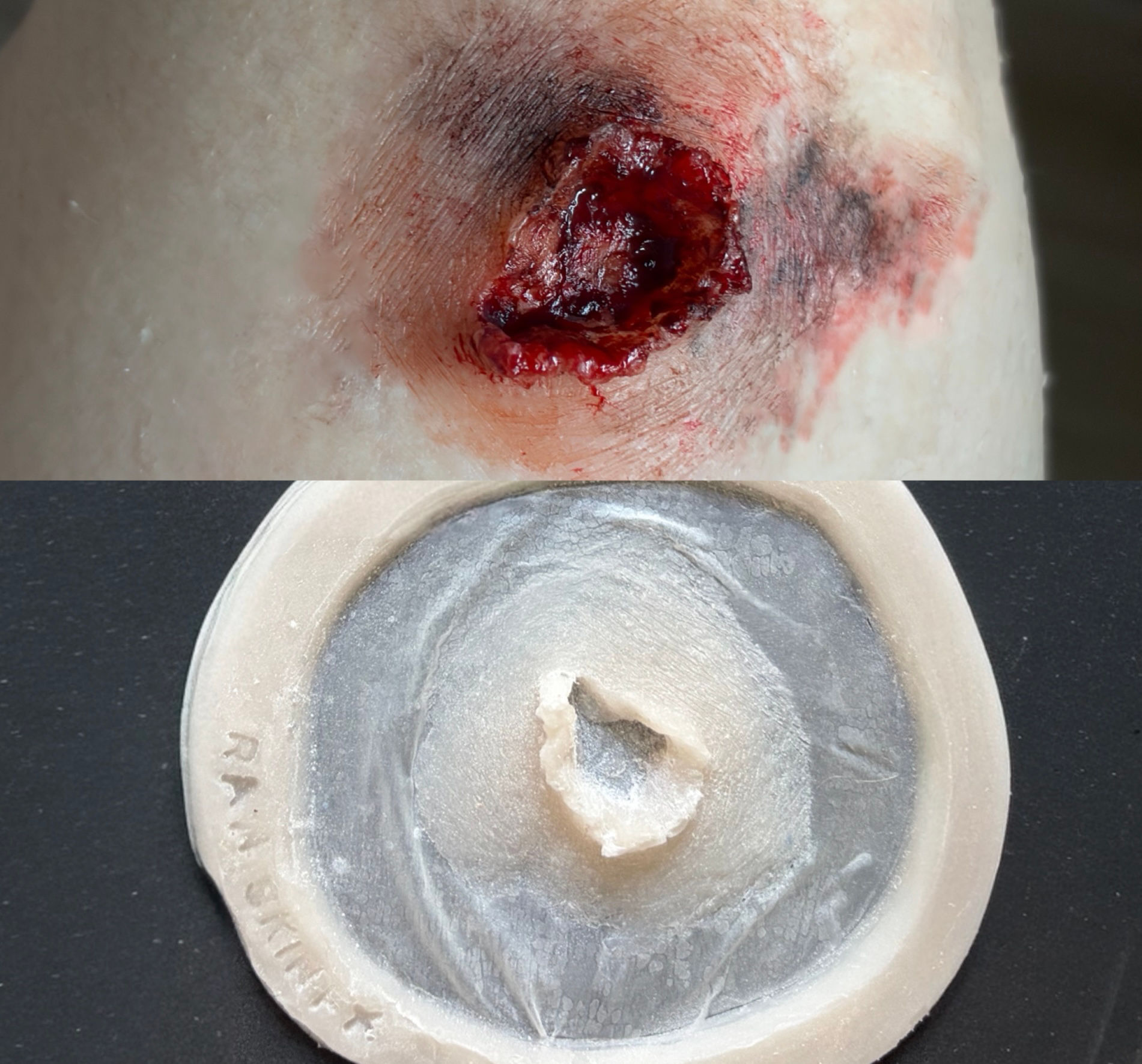 Gunshot Wound Exist