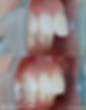 coroa.jpg