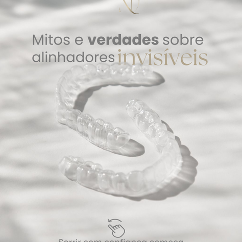 Mitos e verdades sobre alinhadores invisíveis: esclareça suas dúvidas antes de iniciar o tratamento