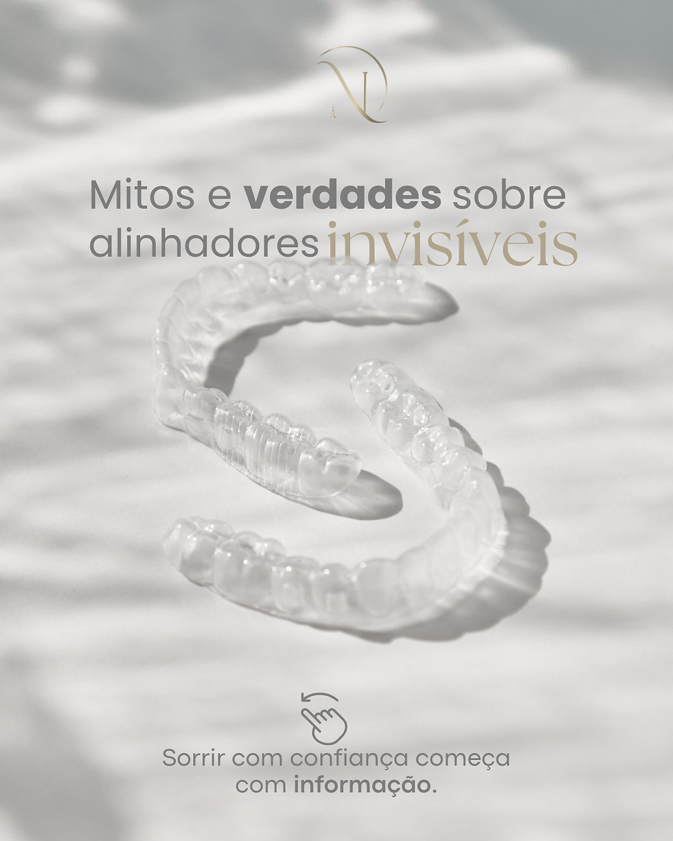 Mitos e verdades sobre alinhadores invisíveis: esclareça suas dúvidas antes de iniciar o tratamento