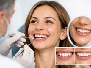 Sorriso gengivale: trattamenti estetici su misura