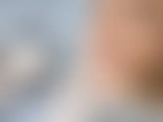 Quando mettere le faccette dentali