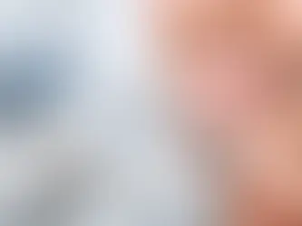 Faccette dentali feldspatiche: quando sceglierle