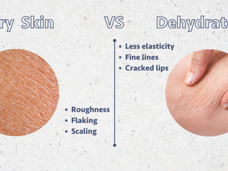Is Your Skin Dehydrated or Just Dry? Here’s How to Tell