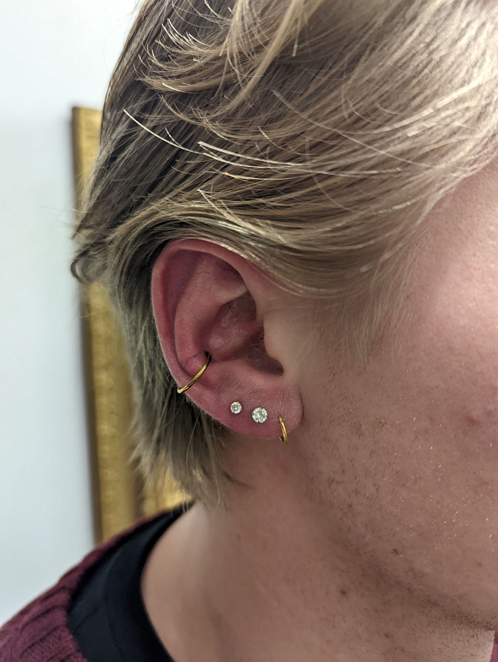 Conch, 2x lobe
