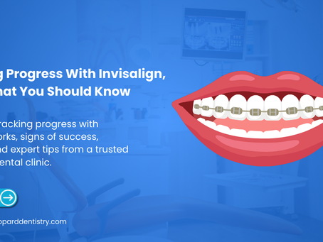 Tracking Progress With Invisalign, What You Should Know