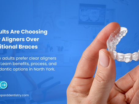 Why Adults Are Choosing Clear Aligners Over Traditional Braces