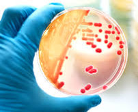 bacteria.jpeg