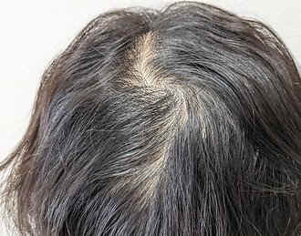 年齢とともに髪質が変化する 「エイジング毛」のサインかもしれません