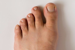 Časté diagnózy, ortopedie nohy