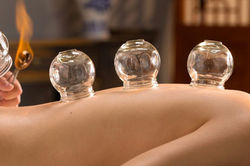 cupping-e1474487984248-1140x760