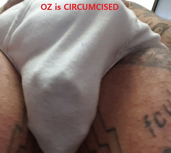 OZ is CIRCUMCISED.jpg