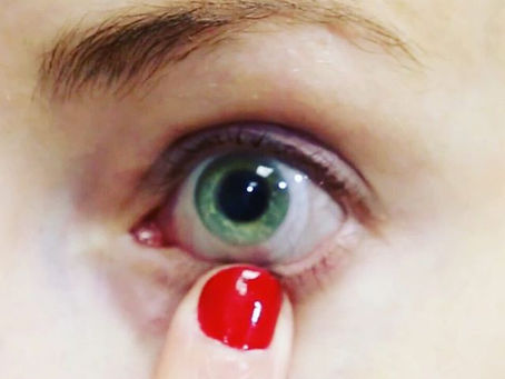 Don't Give Up On Your Eyes! What To Do When You Feel Discouraged About Your Eyesight.