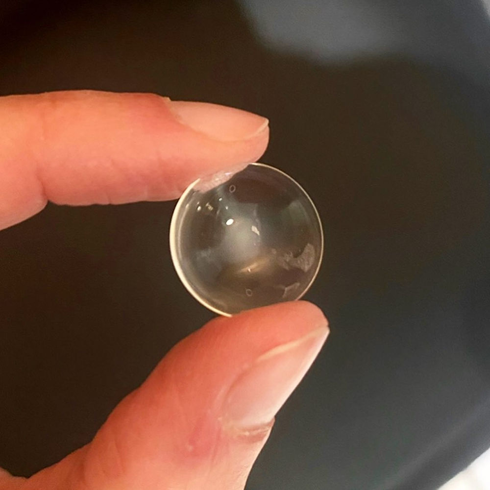 Get Rid of Fogging with Scleral Lenses