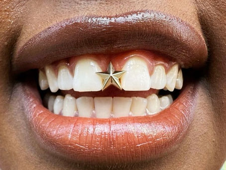 Closing the Gap: The Emotional Side of Changing the Smile I've Known for 34 Years