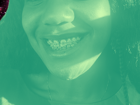 How tf did I pay for braces? 
