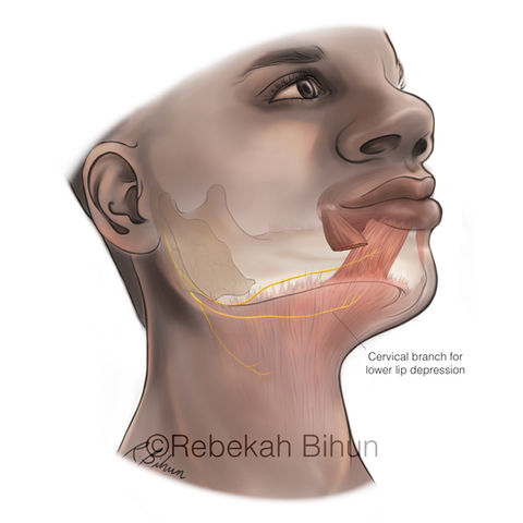 Course of the facial nerve's cervical branch for lower lip depression