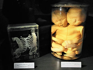 Museum Gustavianum, uppsala, sweden