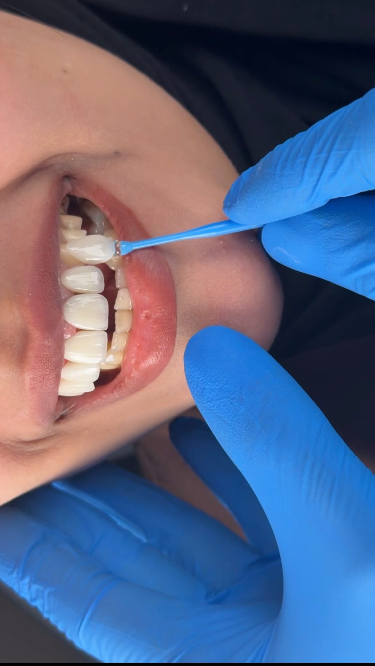 سعادة جديدة هذا الاسبوع ! | عيادة المنصّة لطب الأسنان – الناصرية