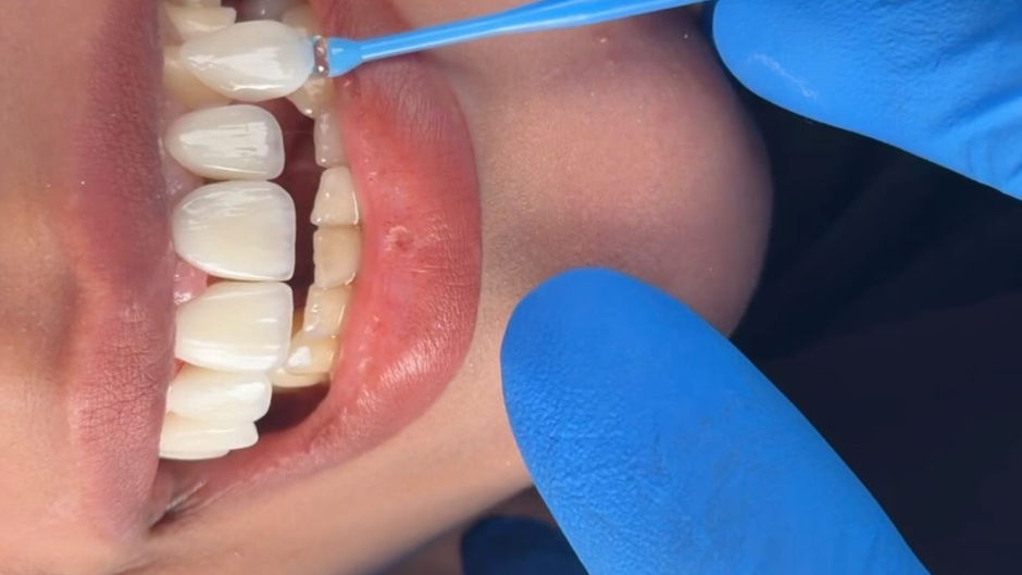 سعادة جديدة هذا الاسبوع ! | عيادة المنصّة لطب الأسنان – الناصرية