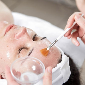 Chemisches Peeling Bad Mergentheim