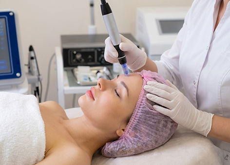Microneedling Behandlung Bad Mergentheim
