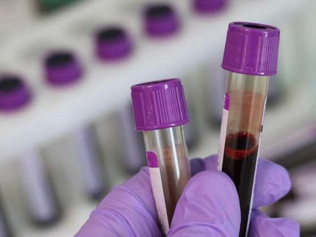 最新肌鈣蛋白血檢(troponin blood test)工具，可望解決急症室無法快速評估患者心臟病發風險