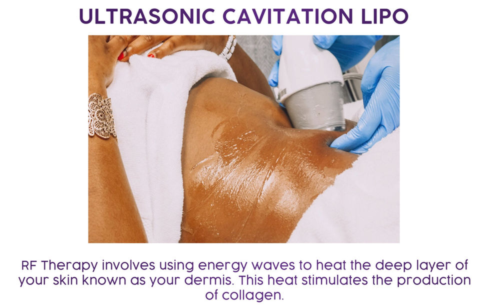 UltrasonicCavitationLipo