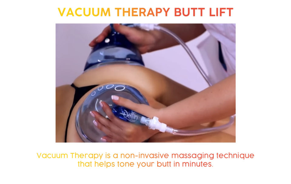 Vacuum Therapy Butt Lift