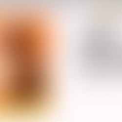 ONME TOP 10: Here are some self-care activities for better mental health