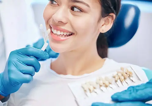 Veneers (8).webp