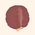female-hair-transplant-_7_.webp