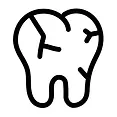 Veneers-3.webp