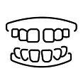 Veneers-_5_.webp