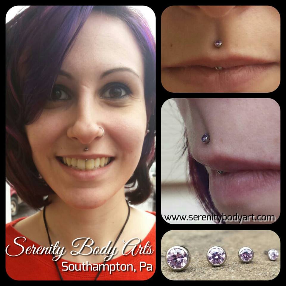 Healed Vertical Philtrum