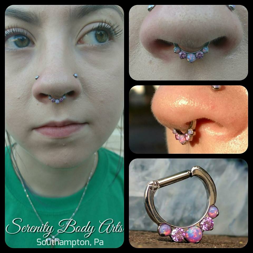 Healed Septum