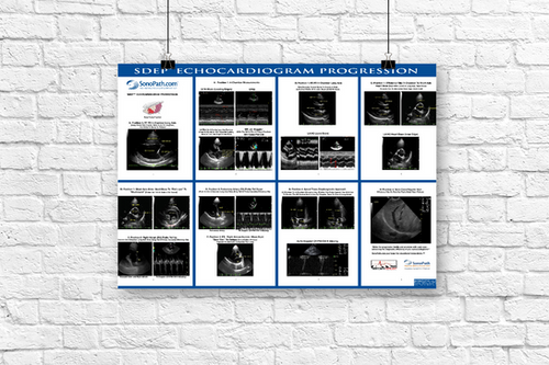 echoページ SDEP® 7 Pt. Echo Progression Poster | SonoPath