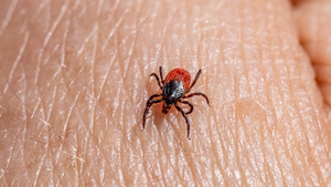 Close-up of a red and black tick crawling on human skin, with fine skin lines visible.