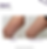 before and after leg