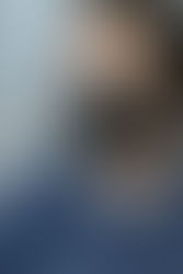 Eye Injury Prevention Month: How to protect your vision?