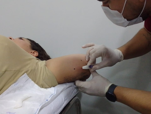 Com investimento do Governo de Mato Grosso do Sul, por meio da SES (Secretaria de Estado de Saúde), o Estado garante a oferta gratuita dos LARCs (sigla em inglês para métodos contraceptivos de longa duração) pelo SUS (Sistema Único de Saúde). O acesso aos métodos acontece a partir das UBSs (Unidades Básicas de Saúde) dos municípios, nas quais a mulher recebe orientação, passa por consulta com a equipe de saúde e inicia o acompanhamento necessário para a escolha do método mais adequado.