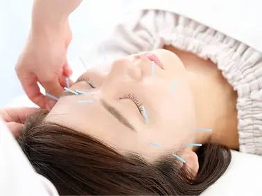 Orangetown-acupuncture-facial.webp