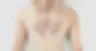 orangetown-acupuncture-hero-2.webp