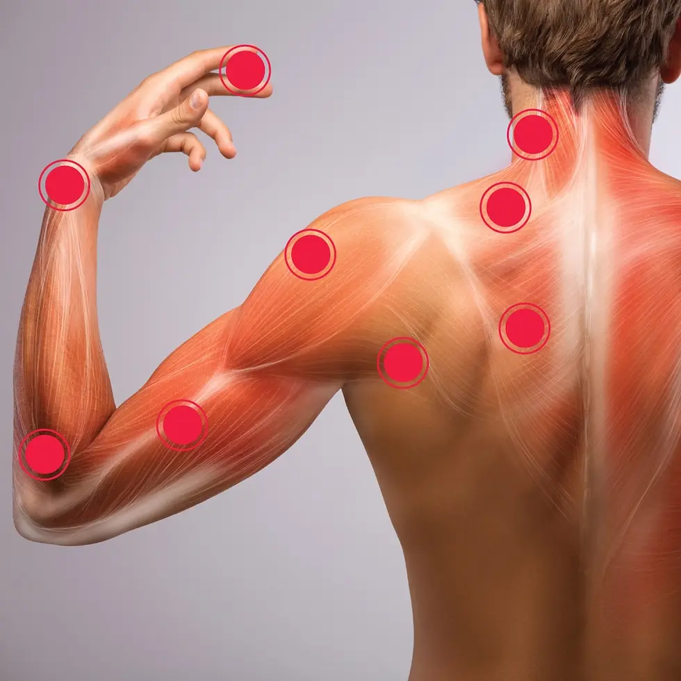 Diagram of cervical radiculopathy pain points in the neck, shoulder, arm, and upper back.