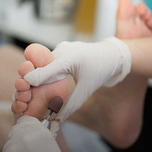 Podólogo puliendo los pies de un paciente