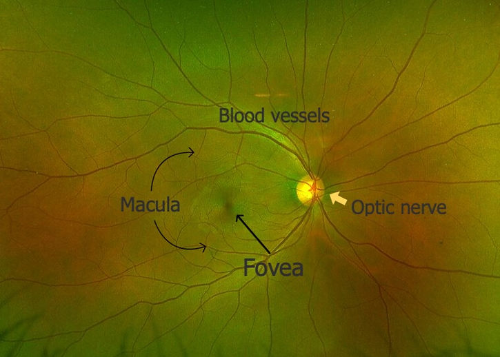 Retinal photograph of normal eye