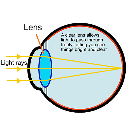 Illustration of a healthy eye without cataract