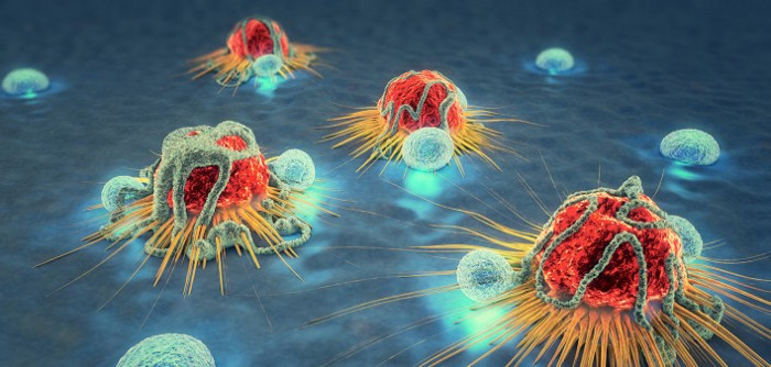 Although it is rare, persistent low back pain can be a sign of a tumor.