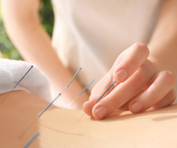 acupuncture stimulates specific acupoints which, in turn, stimulate parts of the nervous system and tells it to feel less pain.