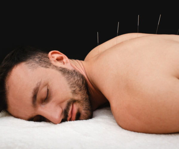Not all guidelines support the use of acupuncture for back pain.